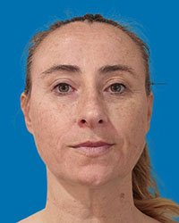 Lindsay Shields